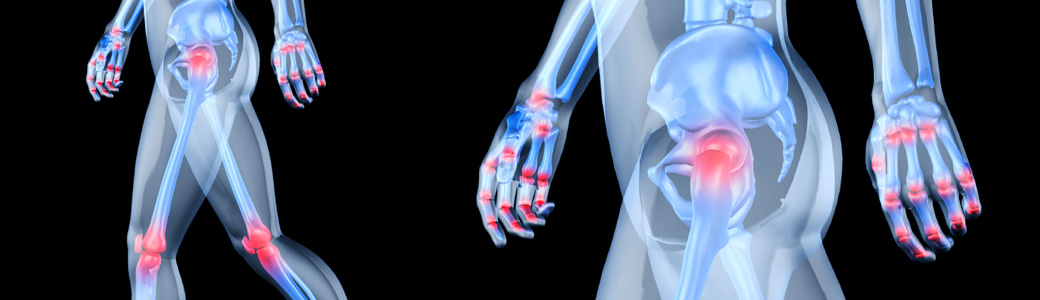 Orthopaedic Physiotherapy